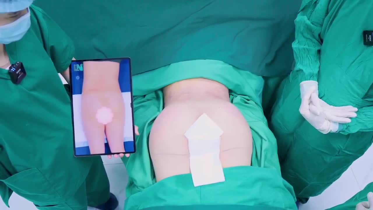 Thay đổi ngoạn mục, hết tự ti vì mông lép, lõm hóp