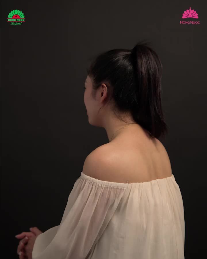 Chỉ 45P phút không đau - Không để lại sẹo - Không nghỉ dưỡng "Cô bé" hồng hào, se khít như thuở mới yêu