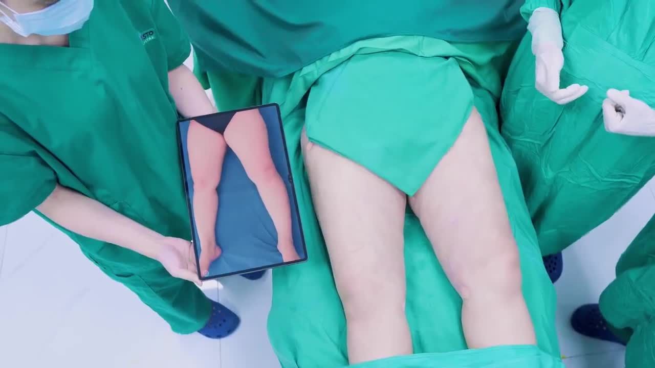 HÚT MỠ TẠO DÁNG THON GỌN VÙNG ĐÙI