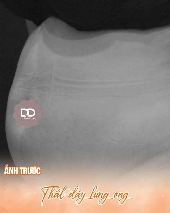 THẮT ĐÁY LƯNG ONG HÓA ĐƯỜNG CONG GỢI CẢM CÙNG DRD