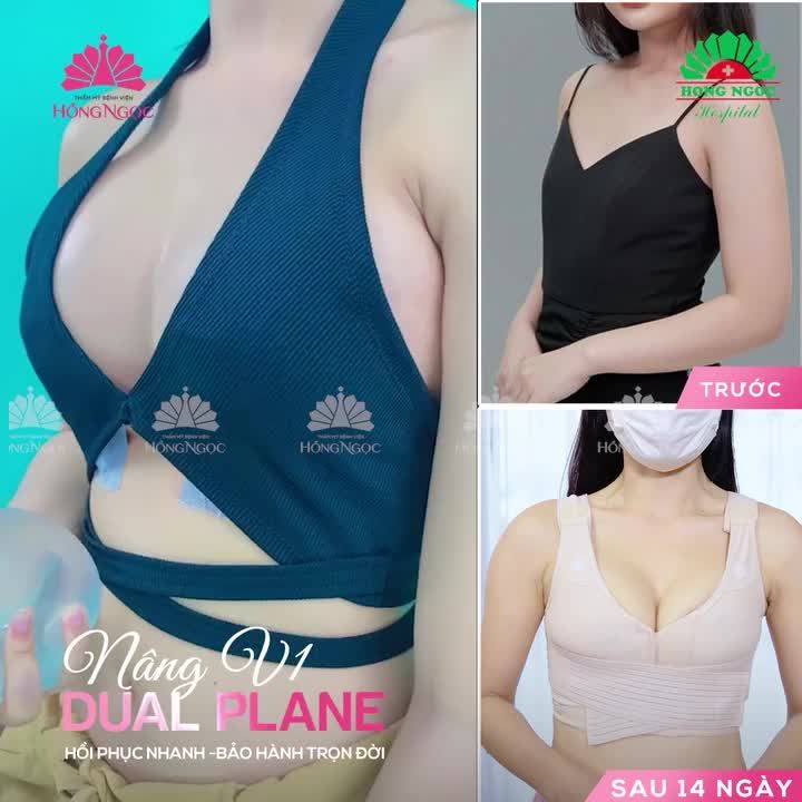 Vòng 1 teo lép sau sinh - Khắc phục như thế nào?