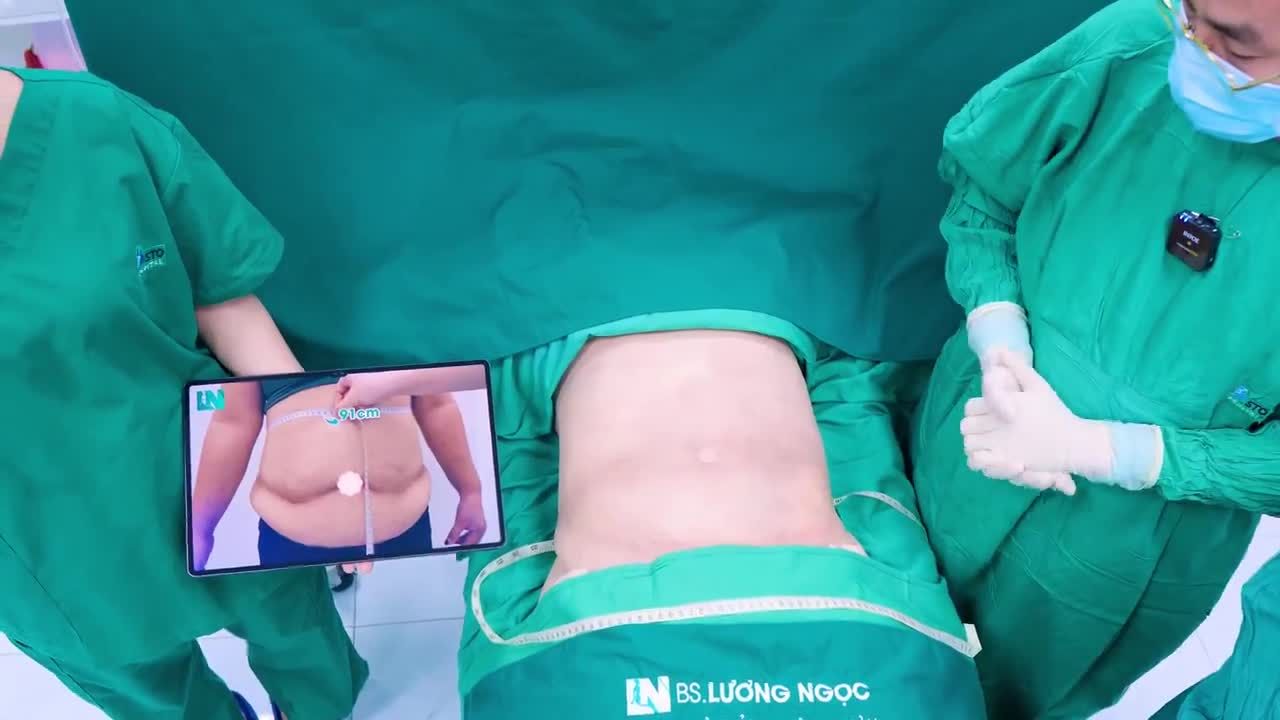 HÚT MỠ TẠO DÁNG MÀ KHÔNG CẦN PHẢI CĂNG CẮT DA.
