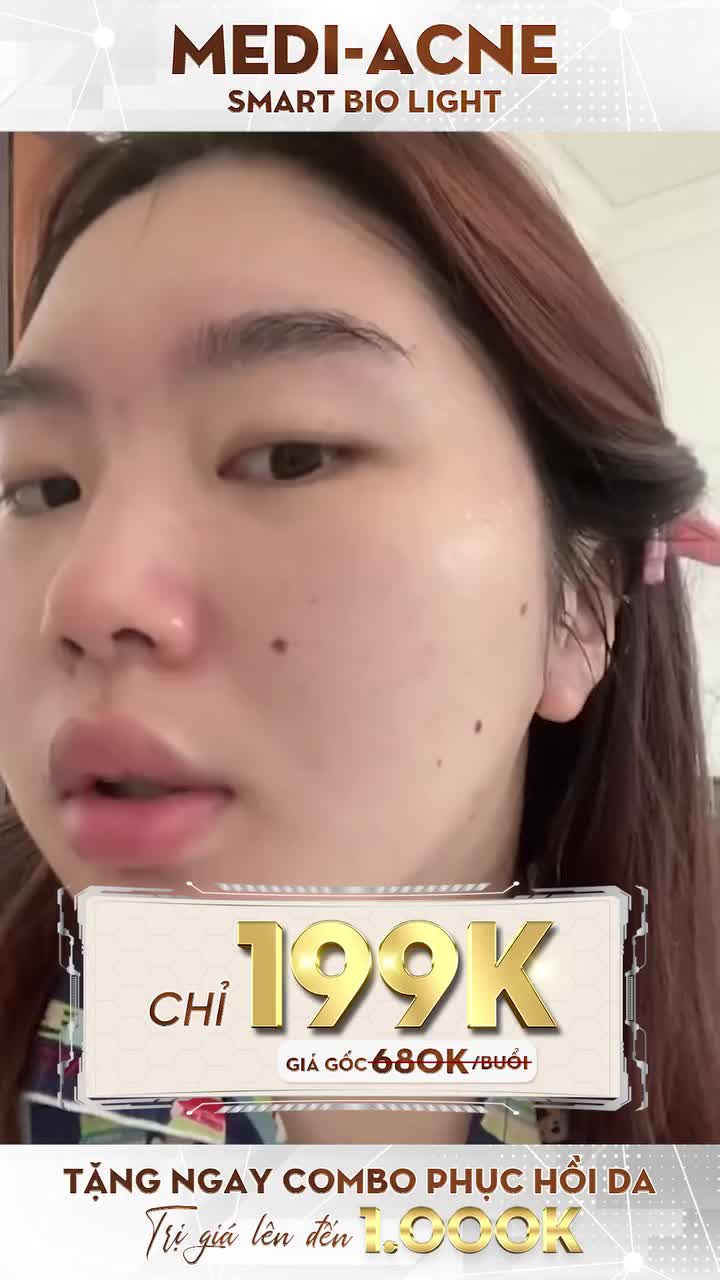 CHỈ 199K – SẠCH MỤN HẾT THÂM VỚI MEDI- ACNE SMART BIO LIGHT