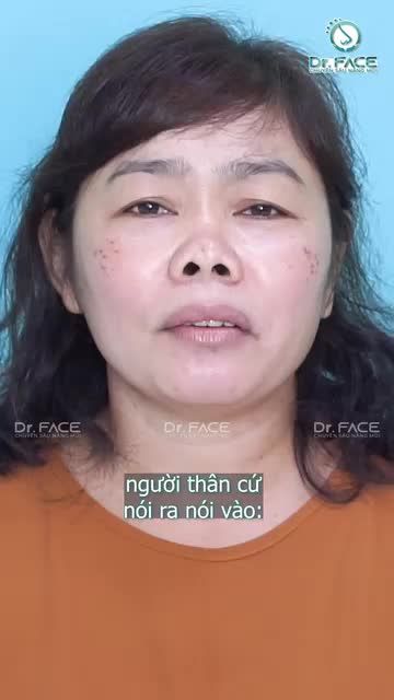 ĐẦU MŨI LÕM MỘT LỖ KỲ CỤC VẬY?