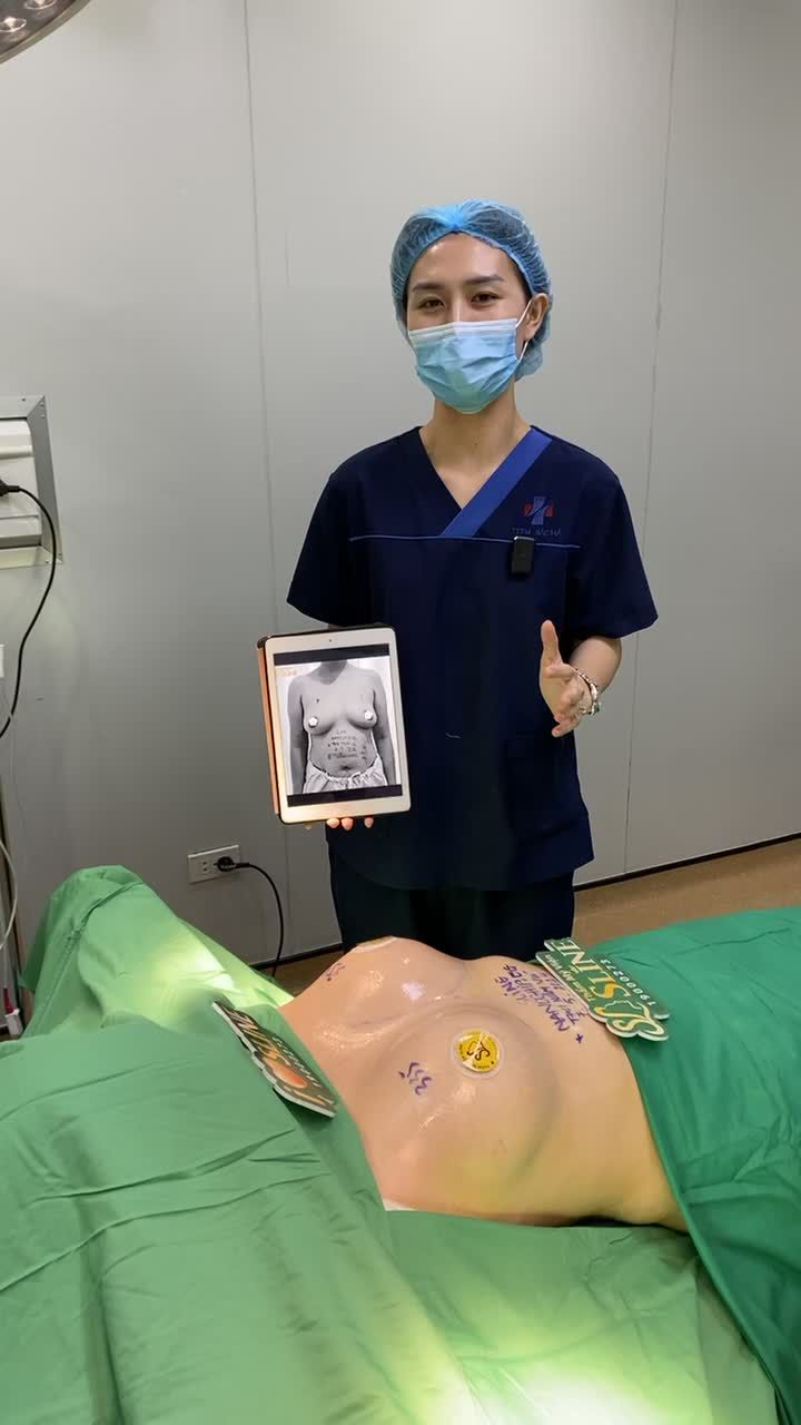 NÂNG CẤP VÒNG 1 VÀ TÂN TRANG "CÔ BÉ"