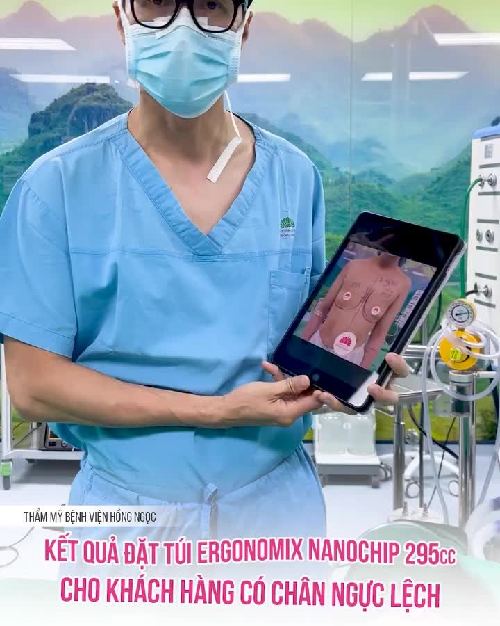 GIẢI PHÁP NÀO CHO V1 LỆCH SIZE ?