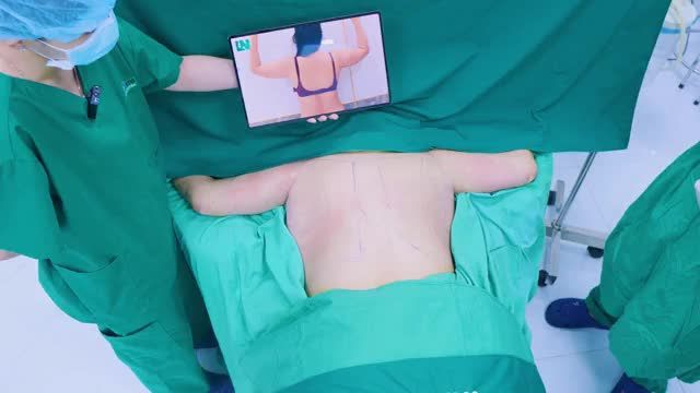 Tay lưng thon thả, nuột nà Da co hồi phẳng phiu, ôm s.á.t vào cơ