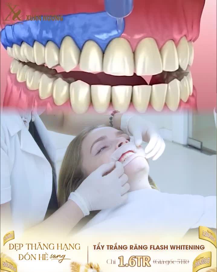 CÁI RĂNG CÁI TÓC LÀ GÓC CON NGƯỜI" - THAY ĐỔI NGAY DIỆN MẠO NHỜ HÀM RĂNG TRẮNG SÁNG