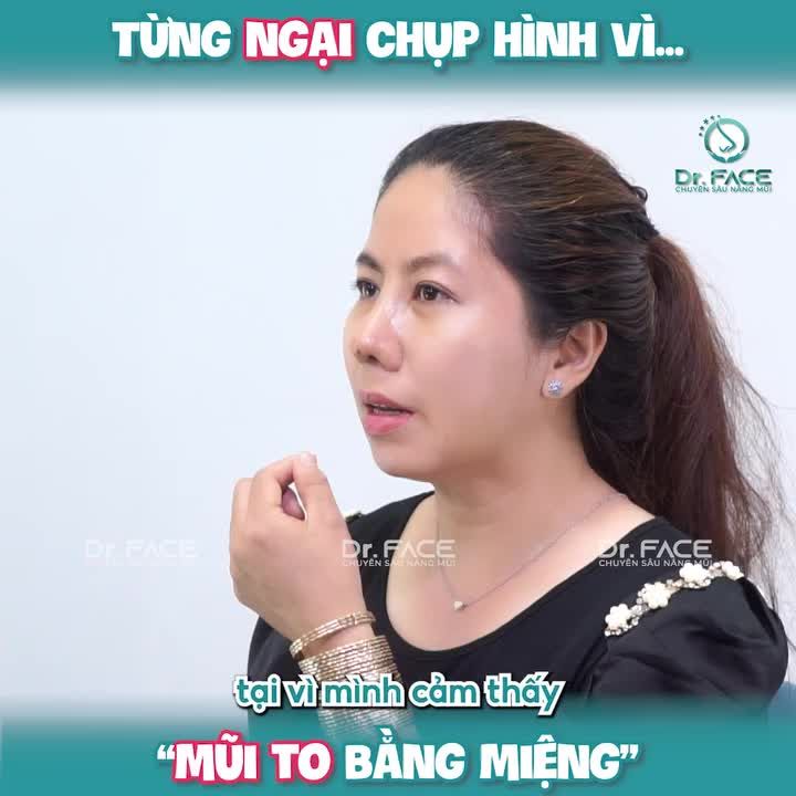 Từng NGẠI CHỤP HÌNH vì… “MŨI TO BẰNG MIỆNG”
