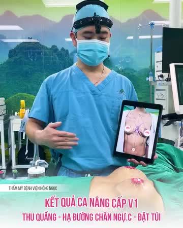 TRƯỜNG HỢP NÀO NÊN THỰC HIỆN NÂNG NGỰC ĐƯỜNG QUẦNG