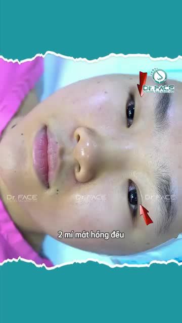 Sinh viên làm MŨI MẮT XỊN CHƯA?