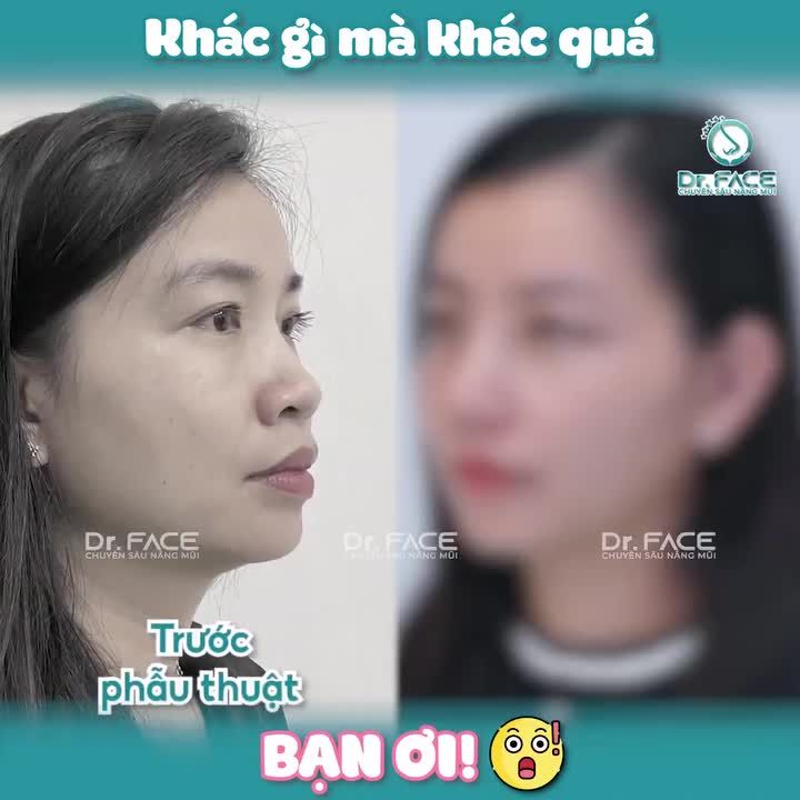 KHÁC GÌ MÀ KHÁC QUÁ BẠN ƠI!