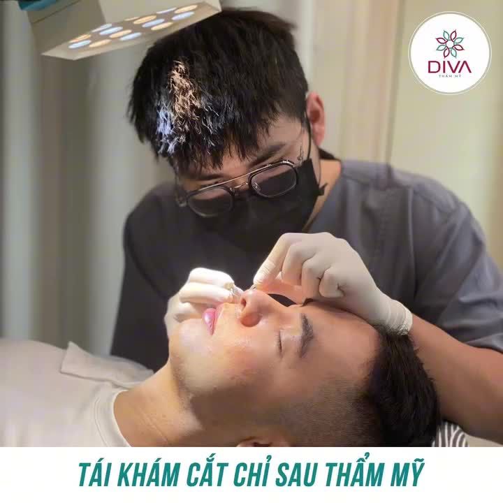 KẾT QUẢ THẨM MỸ] SAU 10 NGÀY CẮT CÁNH MŨI, NÂNG MŨI TÁI CẤU TRÚC GHÉP SỤN TỰ THÂN