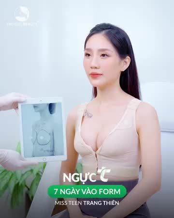 Nâng ngực Miss teen Trang