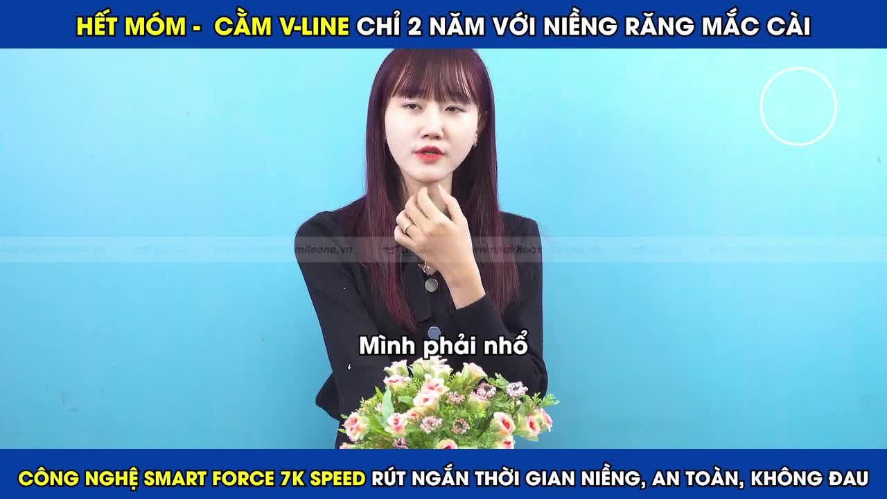 Khách hàng Thu Hiền khắc phục răng móm cằm V-line chỉ sau 2 năm niềng răng.