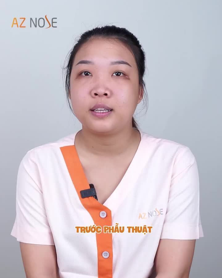 Tín hiệu vũ trụ mách bảo "hãy rủ chị em gái cùng nâng mũi"