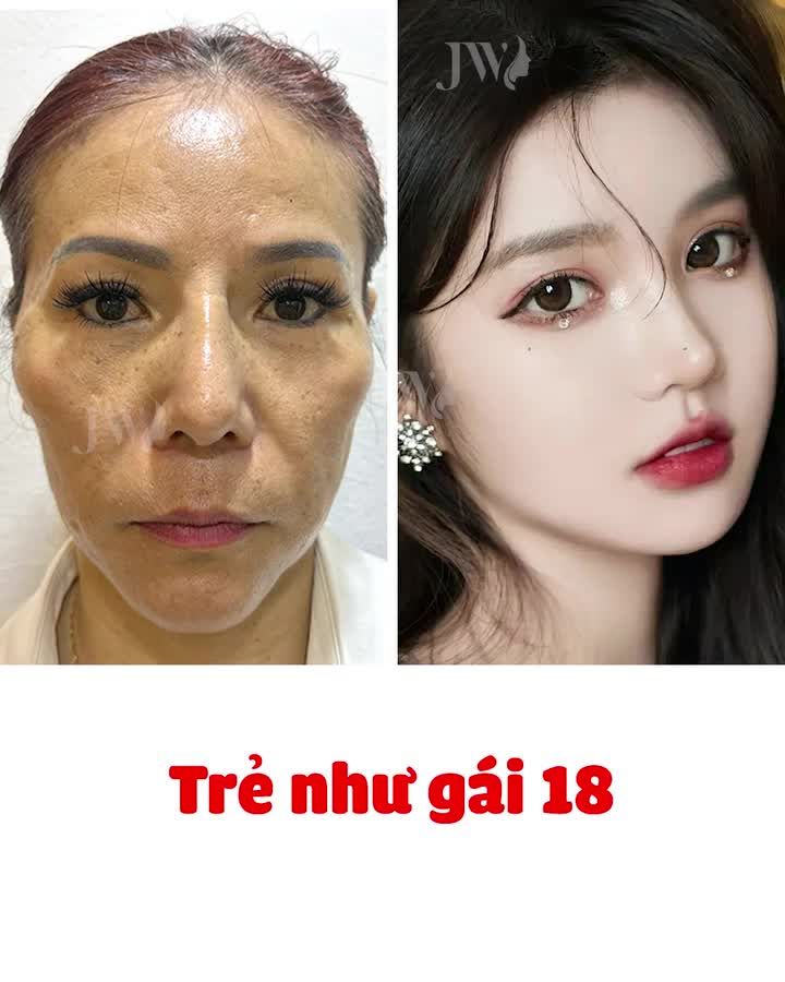 Nữ Việt kiều Mỹ U50 TÁ HỎA vì trẻ 30 tuổi sau 1 đêm hóa baby girl