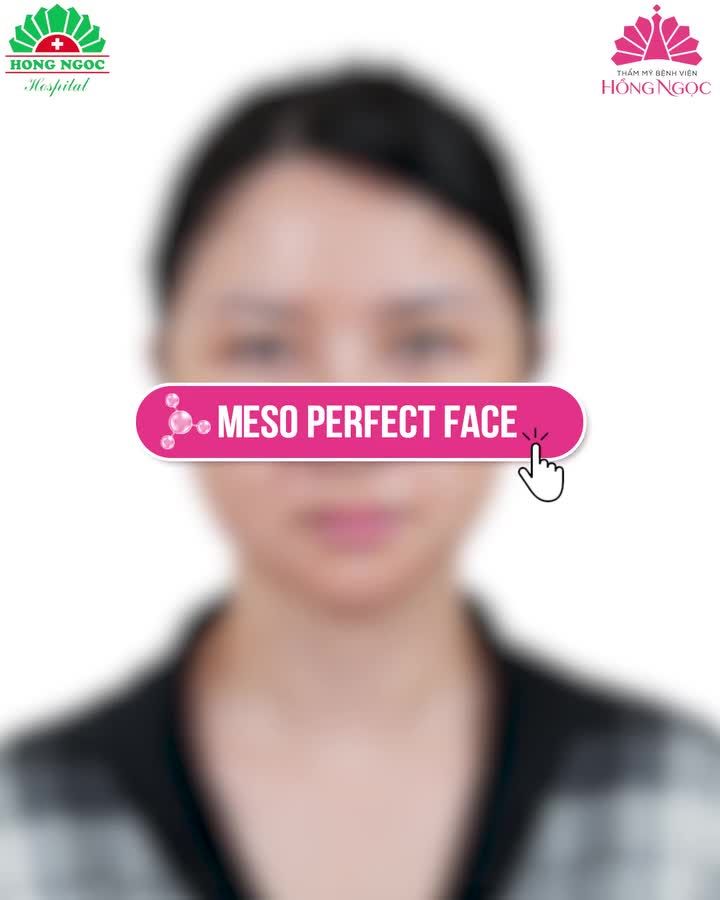 MESO PERFECT FACE - DA ĐẸP TỰ TIN CHẲNG CẦN DÙNG APP