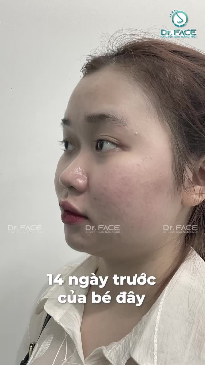 BÍ MẬT 14 NGÀY TRƯỚC CỦA BÉ NÈ…