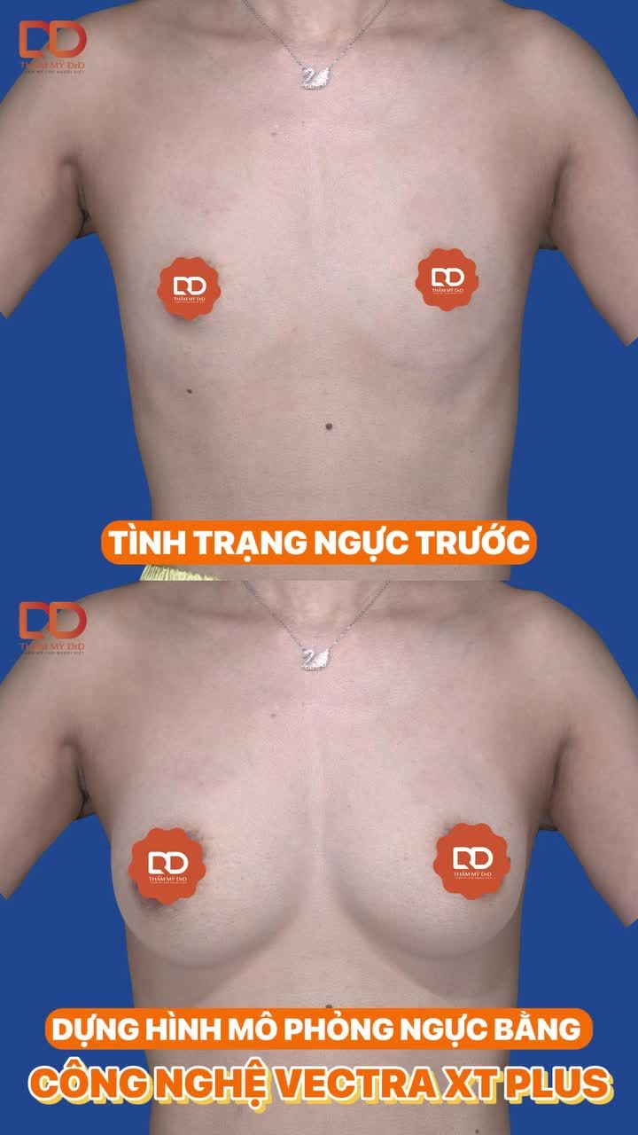 HÀNH TRÌNH BIẾN ĐỔI V1 CỦA KHÁCH HÀNG DRD