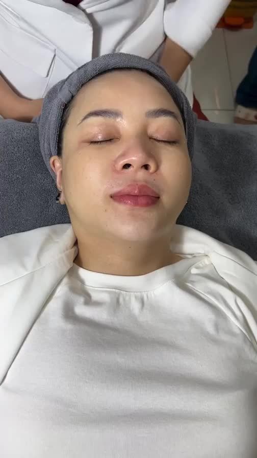 Quý cô U40 da mặt xuất hiện LÃO HÓA đến JW CẢI THIỆN làn da SÁNG MỊN khi tiêm BAP kết hợp tiêm sáng da