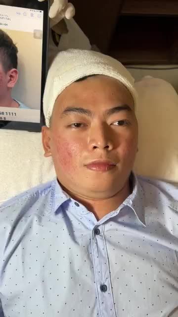 Anh chàng 9X sở hữu làn da SẠCH MỤN 99% chỉ sau 3 buổi ĐIỀU TRỊ tại JW
