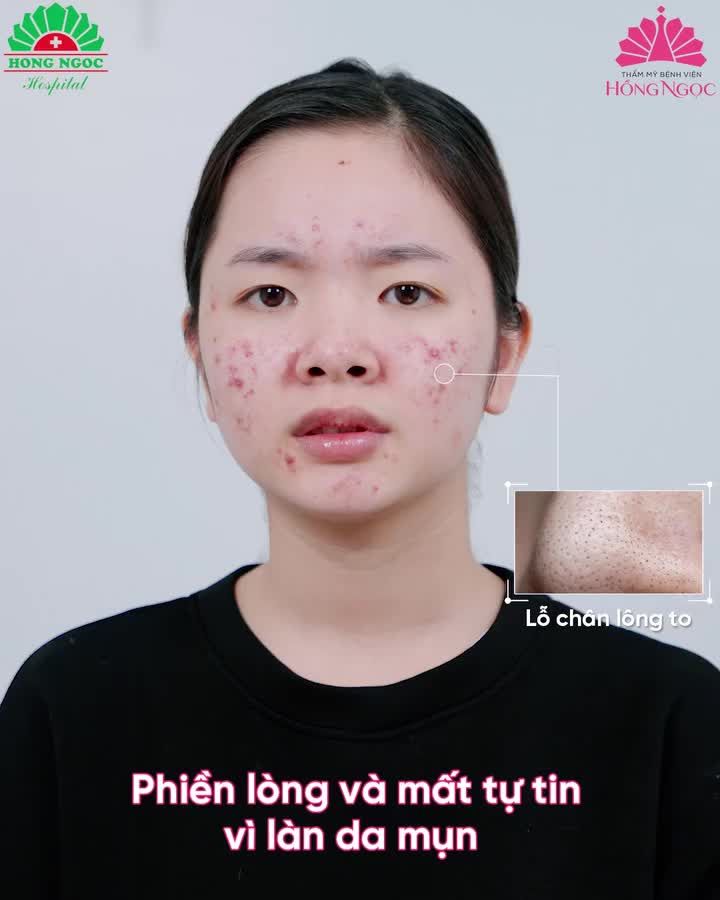ACNE MEDIC: TRỊ MỤN CHUẨN Y KHOA - TỰ TIN VỚI LÀN DA KHỎE ĐẸP