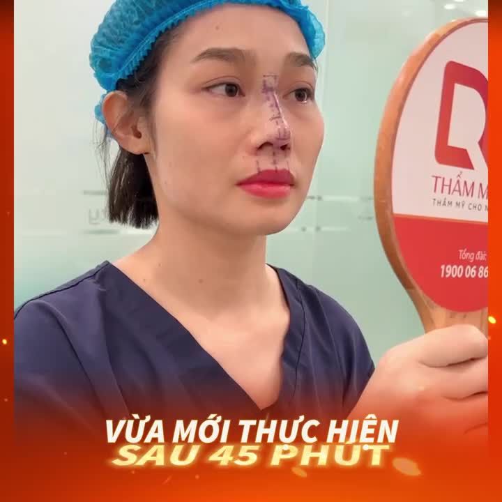 DÁNG MŨI 10 NGÀY CỦA DRD - Tạo đường nét hài hòa tự nhiên, trên gương mặt khách hàng.