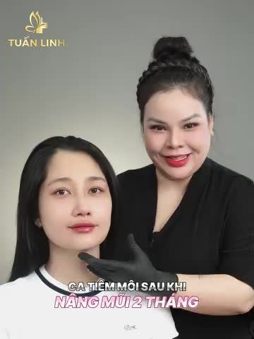 Dáng môi Nga vừa "dứ.t kim" tại Tuấn Linh.
