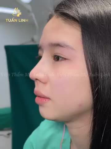 Khách hàng chấm điểm ĐỘ HÀI LÒNG của khách hàng sau phẫu thuật...!