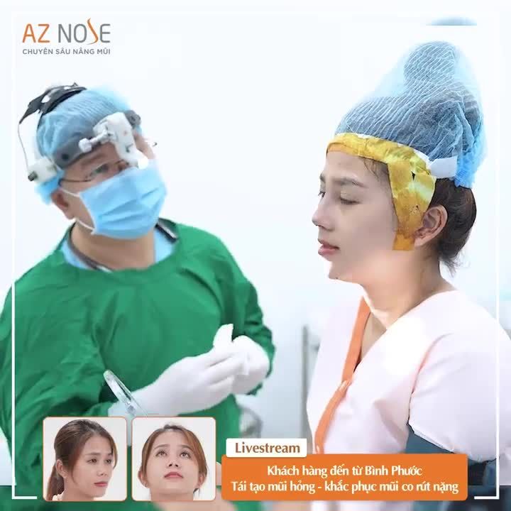 Tái tạo mũi hỏng - khắc phục mũi co rút nặng cho khách hàng đến từ Bình Phước