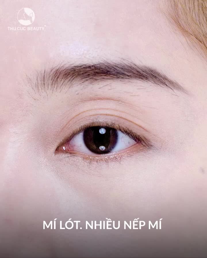 Bạn phù hợp với size mí nào?