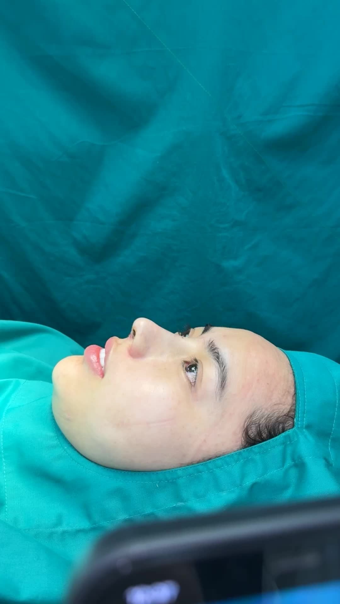 Case cấu trúc sụn bioform vừa hoàn thành!!