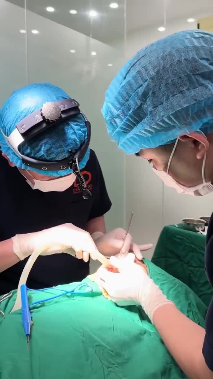 MŨI ĐÃ THÁO NHIỀU NĂM, PHẪU THUẬT ĐẶT CHẤT LIỆU NÊN LÀM ĐỘ CAO VỪA PHẢI, DÁNG MŨI "TỰ NHIÊN".