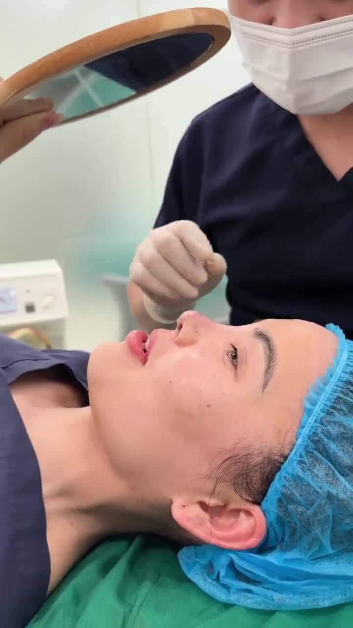 KẾT QUẢ CA NÂNG MŨI - CAO VỪA PHẢI, MỀM MẠI, TỰ NHIÊN