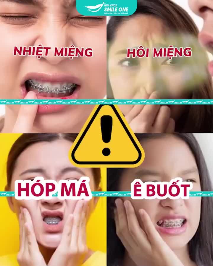 Nhiệt miệng, hôi miệng, hóp má, ê buốt nỗi ám ảnh chỉ những người niềng răng mắc cài mới hiểu!