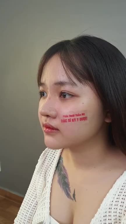 Dáng mũi được bạn khách mơ ước sở hữu từ lâu đã trở thành sự thật.