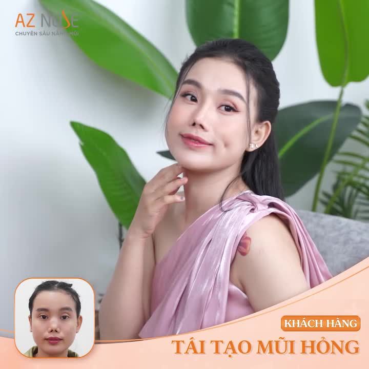 Từng nâng mũi bị h.ỏng, nhưng họ đã "tìm lại t.ự tin"!!