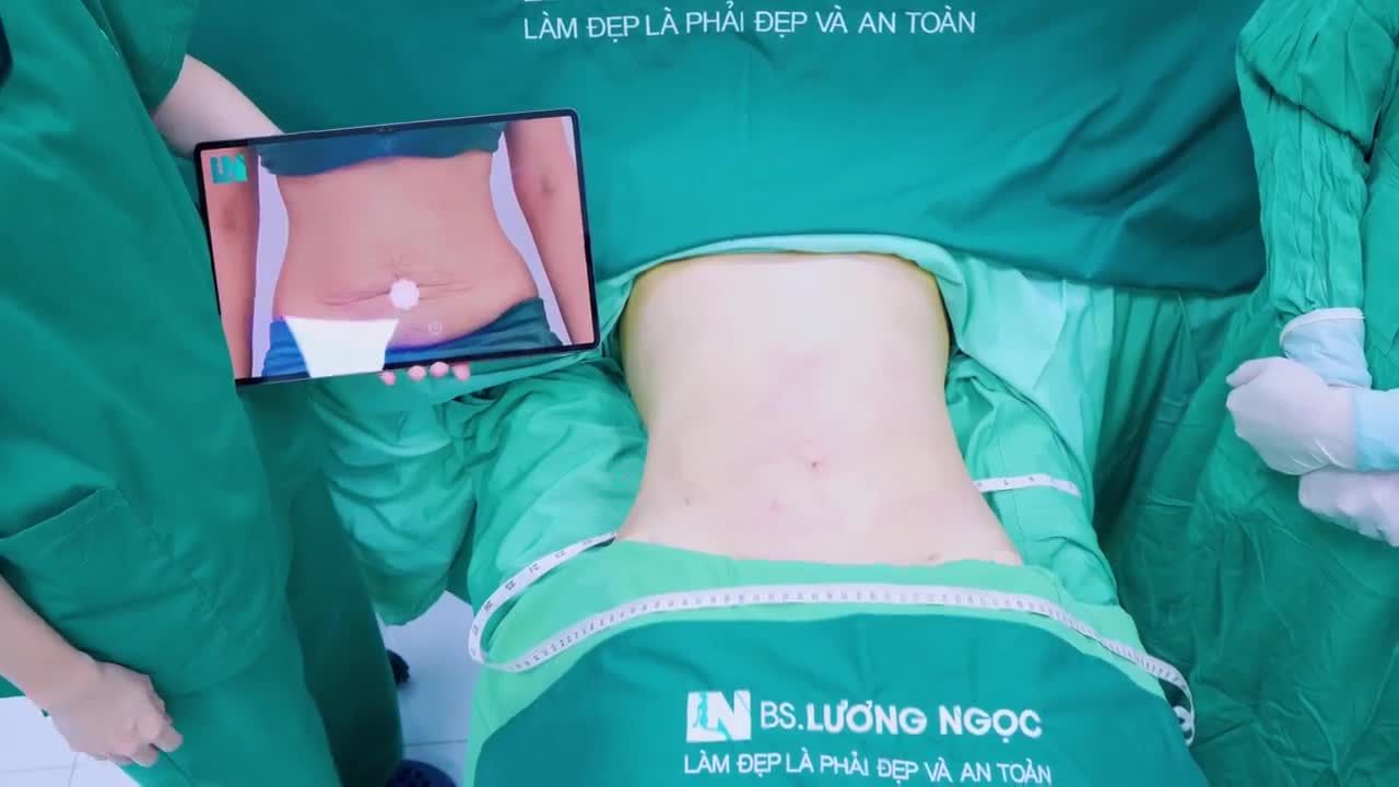 Có ngay vòng eo thon gọn, săn chắc, nuột nà mà KHÔNG CẦN CĂNG CẮT DA với kỹ thuật HÚT MỠ TẠO DÁNG từ Bác sĩ Lương Ngọc