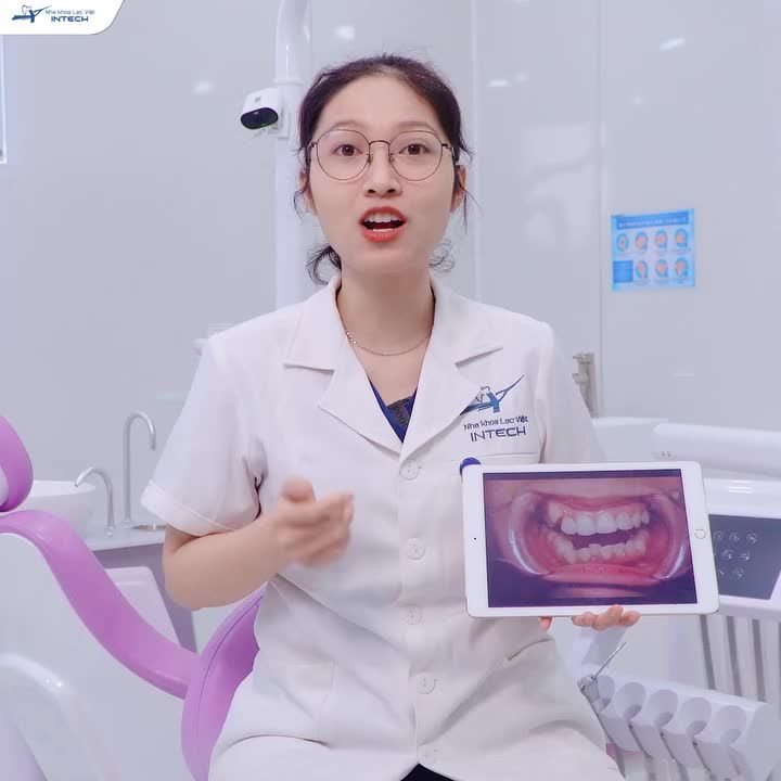 NIỀNG RĂNG X-MATRIX ĐÃ “CỨU” KHÁCH HÀNG KHỎI NGUY CƠ LỆCH MẶT NHƯ THẾ NÀO?