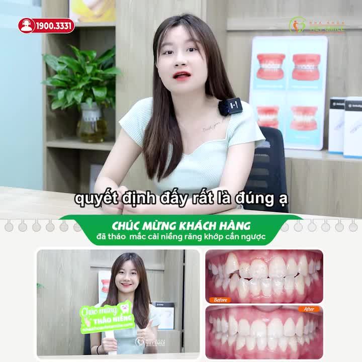 QUYẾT ĐỊNH ĐÚNG ĐẮN KHI CHỌN VIET SMILE NIỀNG RĂNG MÓM