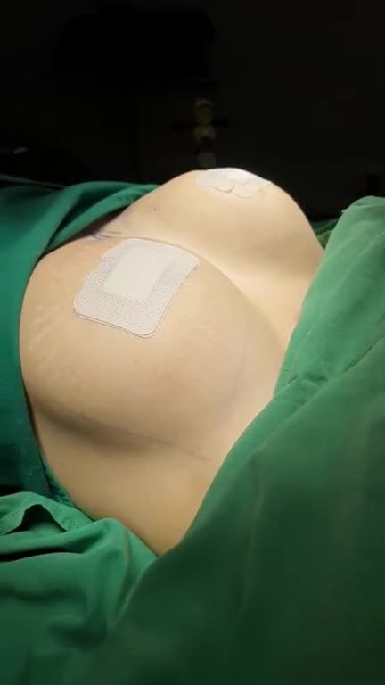 Vòng 1 đẹp như mơ nhờ Tân trang V1 bởi Bác sĩ Kỳ Y Dược.