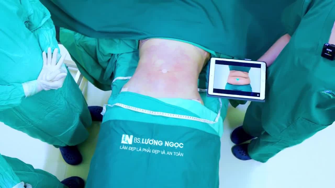 Chị khách cũng tận dụng luôn lượng mỡ lấy ra để cấy mỡ vòng 1 thêm đầy đặn, căng tròn, quyến rũ.