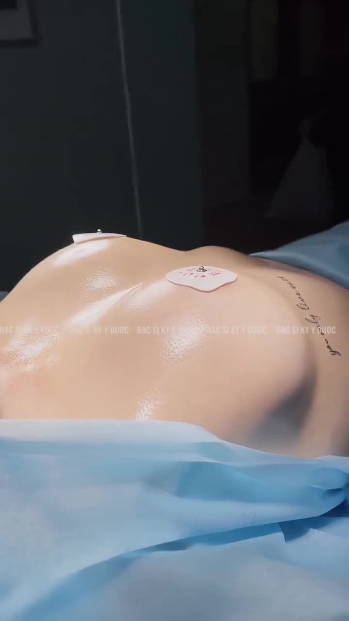Chị khách trẻ tìm đến Bác sĩ Kỳ Y Dược với tình trạng vòng 1 nhỏ, teo lép và không đều khiến chị vô cùng tự ti.