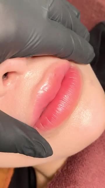 Cận cảnh môi xinh yêu sau 3 ngày bong