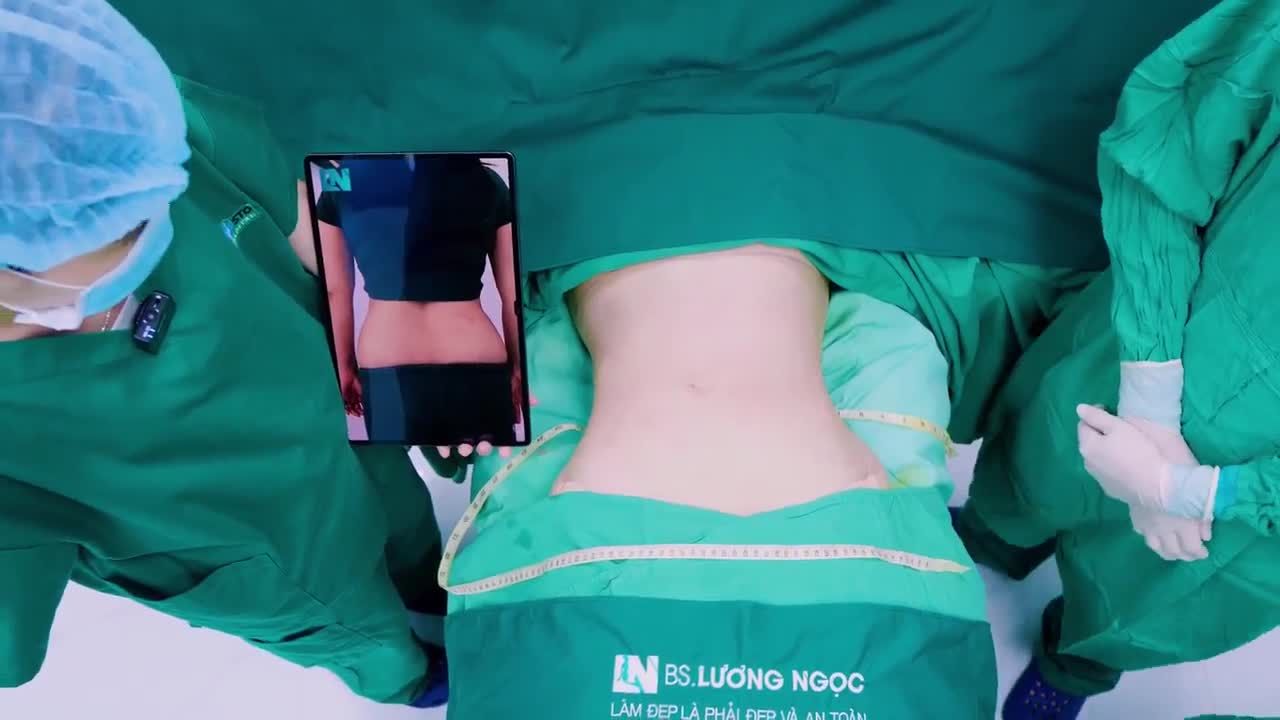 Cách đây 2 tuần bạn BH đã đến với Bác sĩ Lương Ngọc để thực hiện HÚT MỠ BỤNG-EO-HÔNG với kết quả khá ngoạn mục: