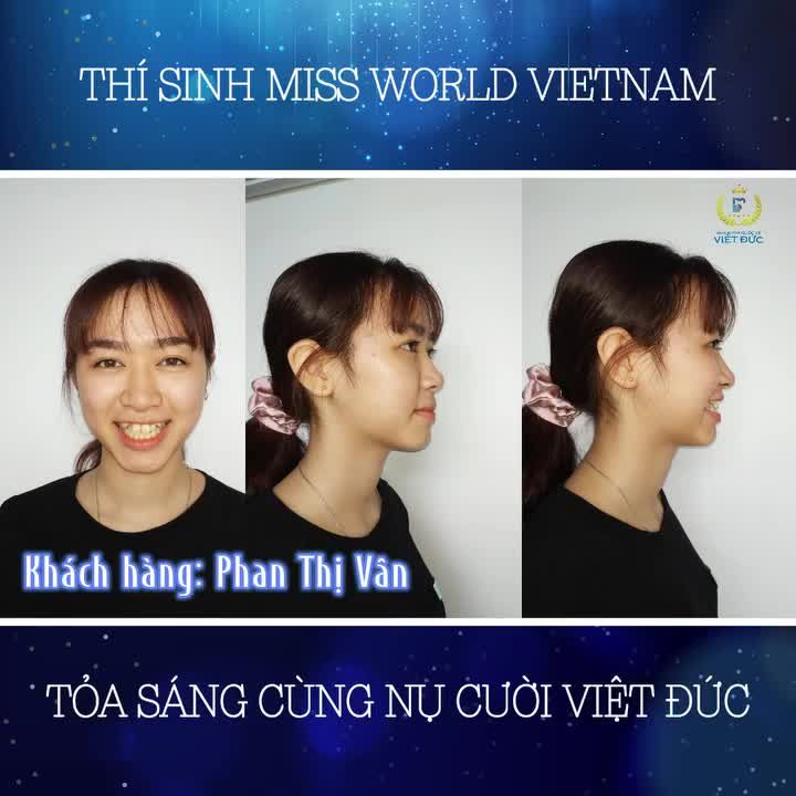 BÍ QUYẾT TỰ TIN TỎA SÁNG TẠI MISS WORLD VIETNAM CỦA CÔ GÁI TỪNG KHÔNG DÁM CƯỜI