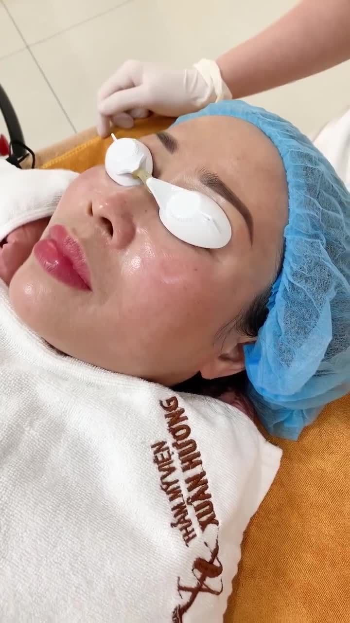 Hút mực phun mày cho chị khách hàng không ưng màu mực tại cơ sở khác