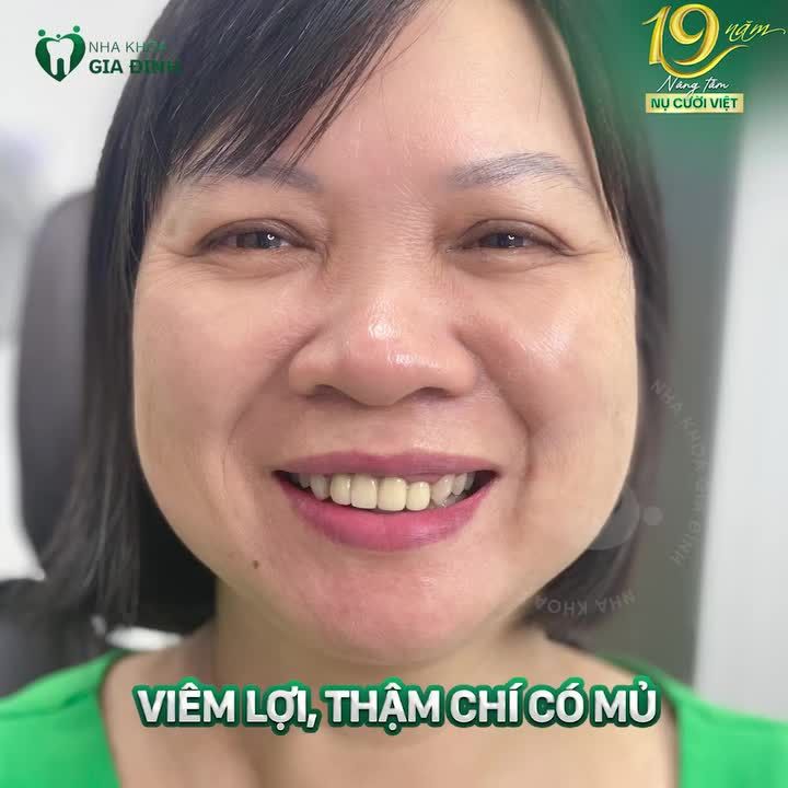 CHO NHỮNG KHÁCH HÀNG TRẢI QUA NỖI ĐAU BỌC RĂNG SỨ HỎNG