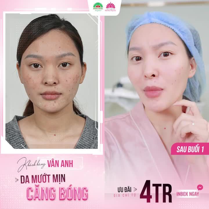 TƯỞNG KHÔNG ƯNG MÀ ƯNG KHÔNG TƯỞNG